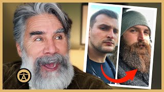 Berzinsky Reacts to SHOCKING Patchy Beard Transformations