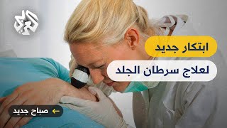 الجلد الصناعي .. اختراق طبي قد يمهد الطريق للقضاء على سرطان الجلد