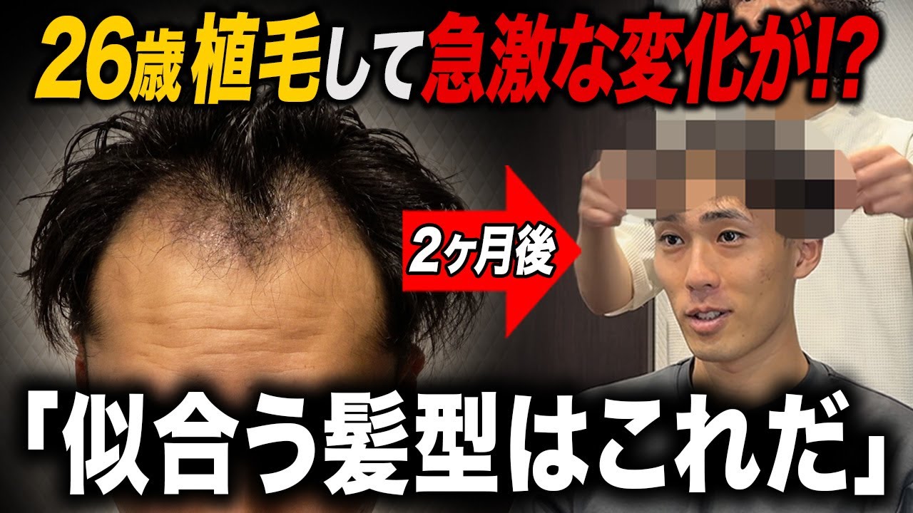 Dramatic transformation] 26-year-old's hairstyle changes after