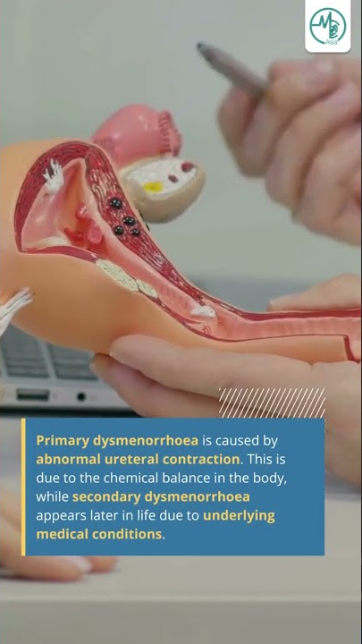 Painful periods? It could be dysmenorrhoea! | #MCAshorts