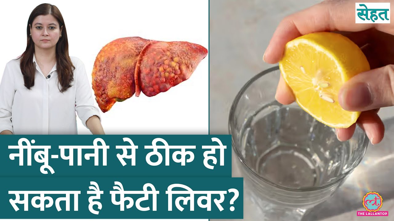 Lemon Water से Fatty Liver ठीक होने का दावा सच है या झूठ? | Sehat Ep. 1182