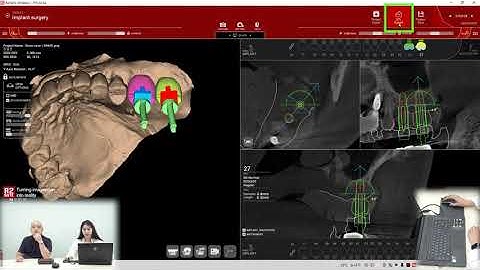 #Episode 06. R2 Planning for sinus graft