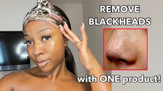 HOW TO REMOVE BLACKHEADS FROM FACE / NOSE ( Permanently) ‼️