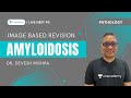 Amyloidosis | Image based Revision (PGMEE) | Dr. Devesh Mishra