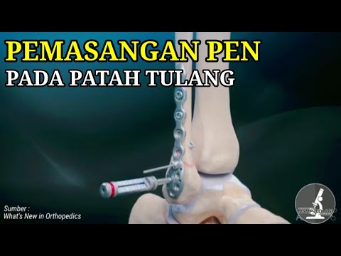 Video: Gergaji pemasangan logam: gambaran keseluruhan