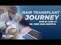 Hair Transplant Journey Step By Step | Hair Transplant | Dr. Emrah Cinik