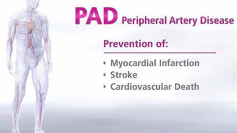 What is Peripheral Artery Disease - Mechanism of Disease