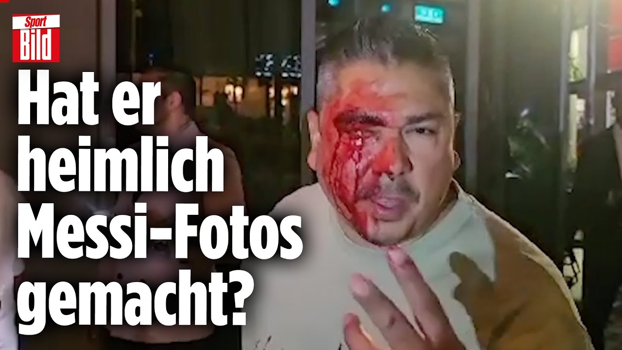 Brutale Schlägerei vor Wiener Hotel