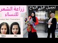 تجميل قبل الزواج للعروسة والعريس انصدمت من زراعة الشعر