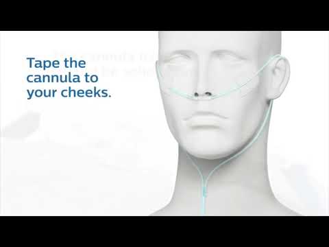 Home Sleep Apnea Test (HSAT)