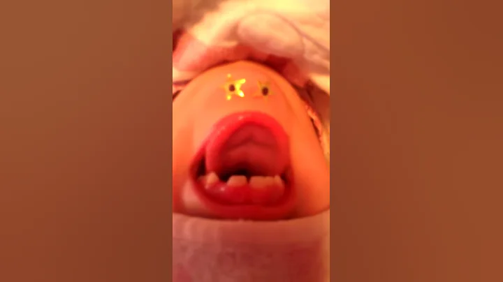 Chinface Kaylee