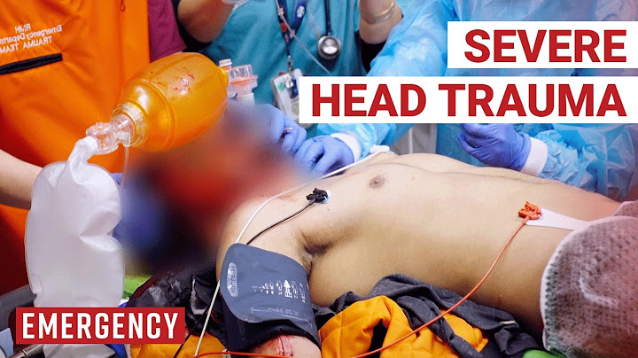 Motorcyclist Thrown Head On Into Windscreen Is Critical! | Emergency