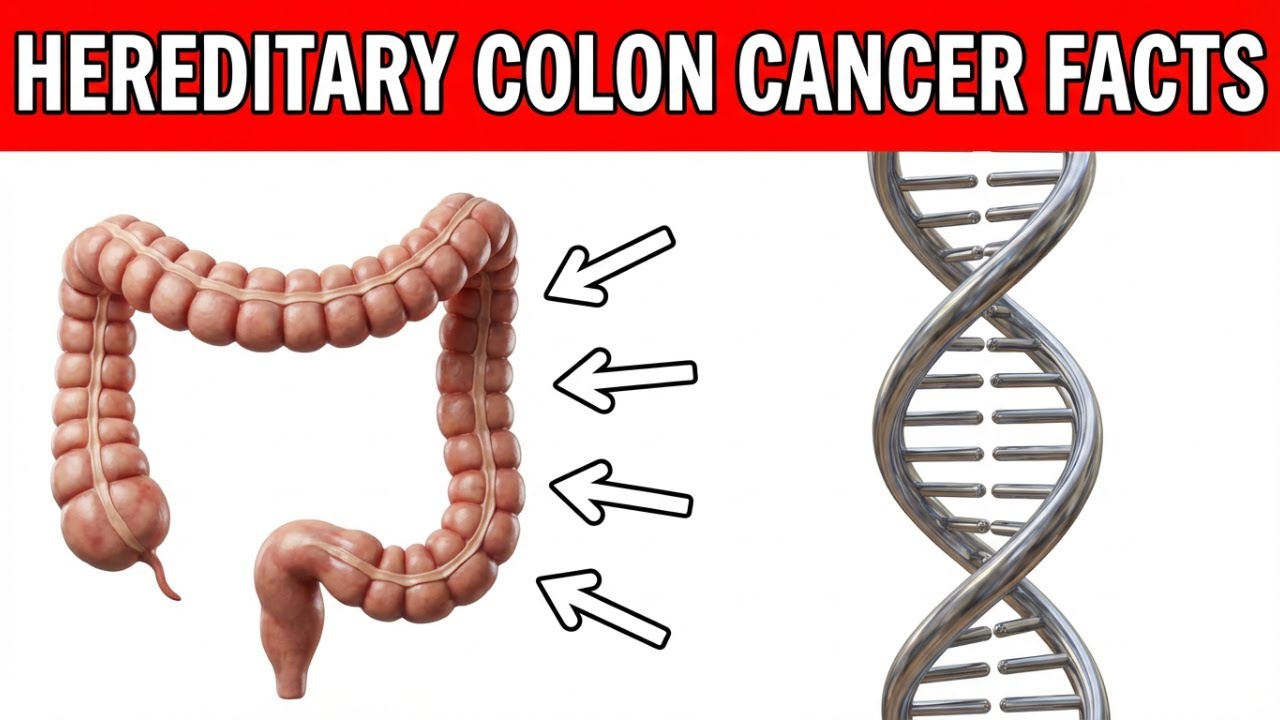 Hereditary Colon Cancer: Genetic Syndromes, Screening, and Risk Reduction