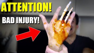 Attention! - Bad Injury! - WATCH OUT!