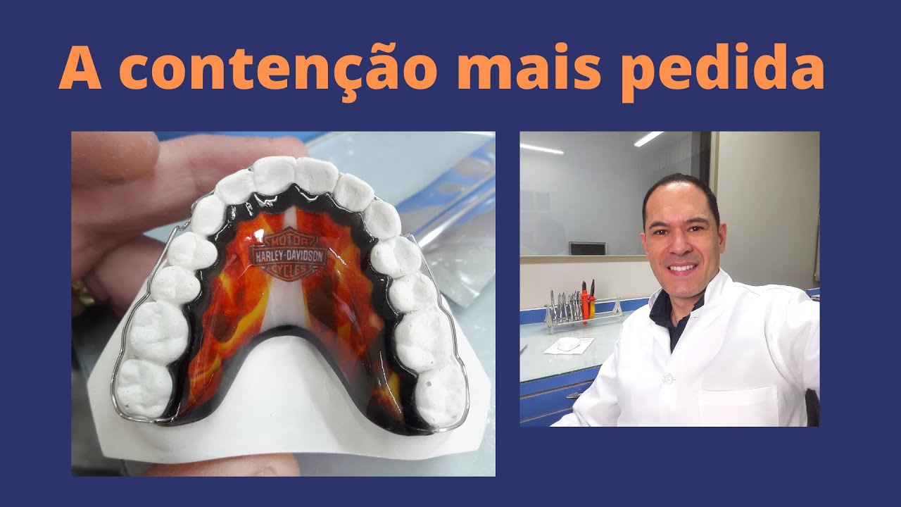 Contenção com Arco Contínuo (Descomplicado)