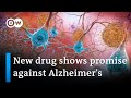 New Alzheimer