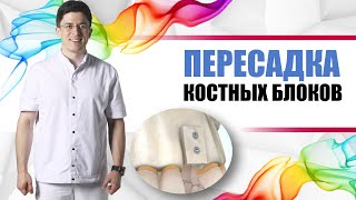 Наращивание костной ткани, пересадка костных блоков для имплантации зубов.