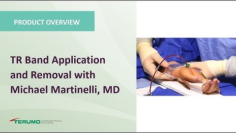 TR Band Application and Removal with Michael Martinelli, MD | Terumo Interventional Systems