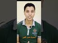 هالات سوده تحت العين