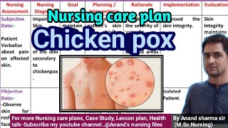 Nursing care plan on Chickenpox/varicella//Nursing Diagnosis and Interventions for chickenpox
