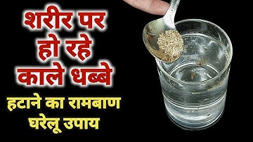 हाथ-पैर या शरीर में हो रहे काले धब्बे(निशान) को ठीक करने का 100% पक्का घरेलु उपाय बस एक बार इसे खाएं