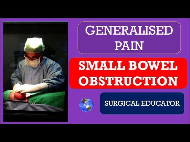 SMALL BOWEL OBSTRUCTION- How To DIAGNOSE u0026 TREAT / GENERALISED ABDOMINAL PAIN class=