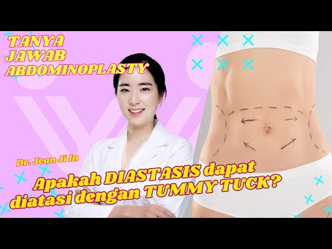 Dapatkah DIASTASIS diatasi dengan TUMMY TUCK? | Tanya Jawab Abdominoplasti | Dr Jeon Ji In