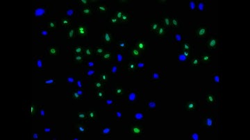 Viability determination of HeLa cells using ReadyProbes® Cell Viability Imaging Kit (Blue/Green)