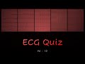 Ecg quiz 6  10