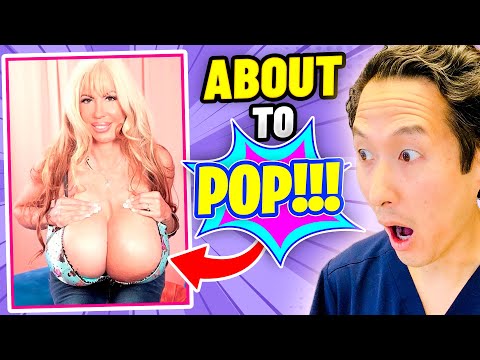 Plastic Surgeon Reacts to LARGEST BREASTS Ever!! EXTREME Bodies EXPLAINED!