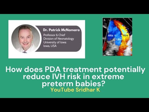Is there an association between PDA patency and IVH in extreme preterm babies? Dr Patrick Mcnamara