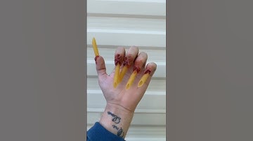 Cutting Off an Extra Finger?! (@sfxbydavid on Tik Tok)#shorts
