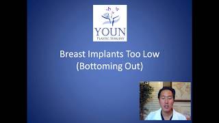 Why Are My Breast Implants Too Low - Capsulorrhaphy Consultation - Dr. Anthony Youn