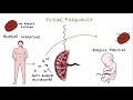 Understanding Rhesus Status and Anti-D in Pregnancy