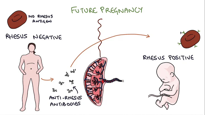 Understanding Rhesus Status and Anti-D in Pregnancy