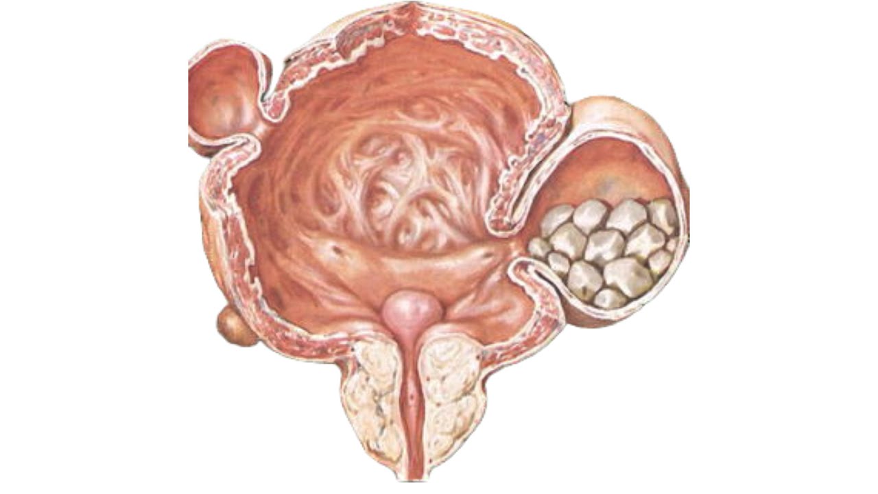 جيب المثانة