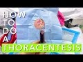 How to do a thoracentesis