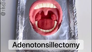 Playdough Surgery - Tonsillectomy and Adenoidectomy