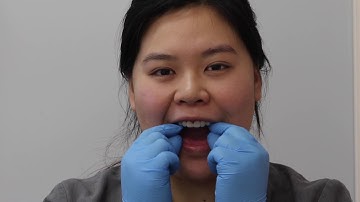 How to Use Dental Monitoring