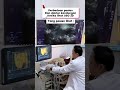 Perbedaan Pasien Dan Dokter