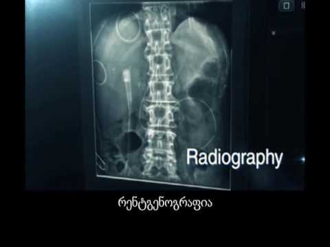 თანამედროვე ციფრული რენტგენი