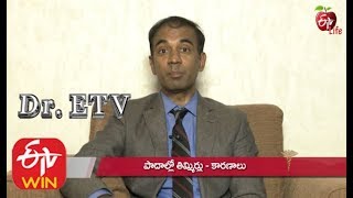 Sensory Neuropathy Peripheral Sensory Neuropathy Sensory Motor Neuropathy