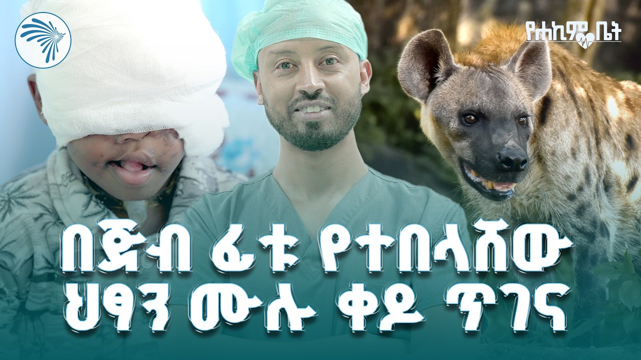 በጅብ የተበላው  ህፃን መጨረሻ ምን ሆነ ? // የሐኪም ቤት // @ArtsTvWorld