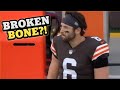 Baker Mayfield BROKE HIS SHOULDER?! Doctor Reacts to New Injury Updates