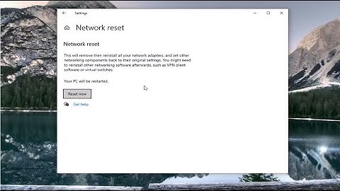 How to Fix DHCP Lookup Failed Error In Windows 10 [Tutorial]