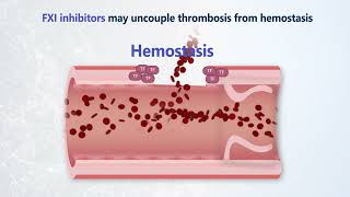 Emerging Solutions for Safer Anticoagulation: Why Factor XI?