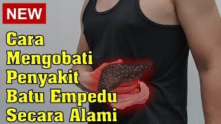 Manfaat Minyak Zaitun | SEHAT SANTUY (18/04/21)