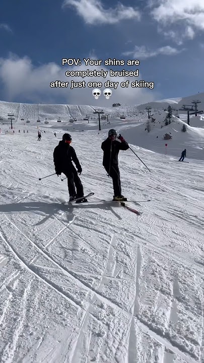 why-do-my-shins-always-hurt-after-a-day-of-skiing-ski-snowboarding