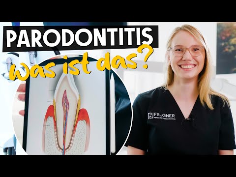 Video: Zahnwachstum. Alles Was Sie Darüber Wissen Müssen