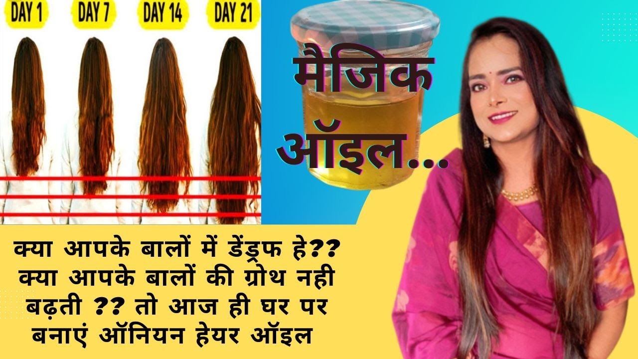 kya aapko hair fall he? ya hair dry or damaged ho gye he? to Aaj aap